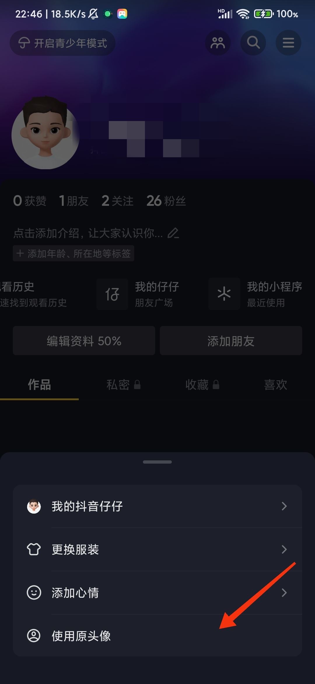 抖音仔仔怎么關(guān)閉？