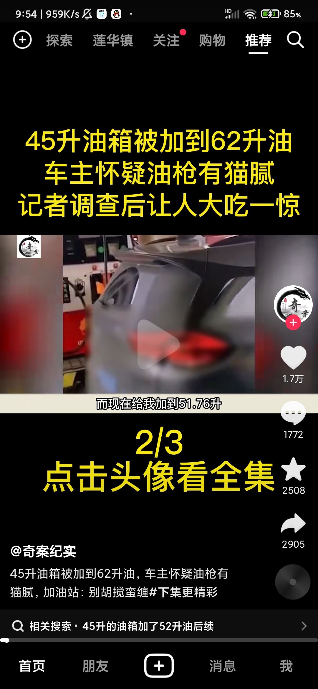 抖音頭像上快進按鈕怎么設置？